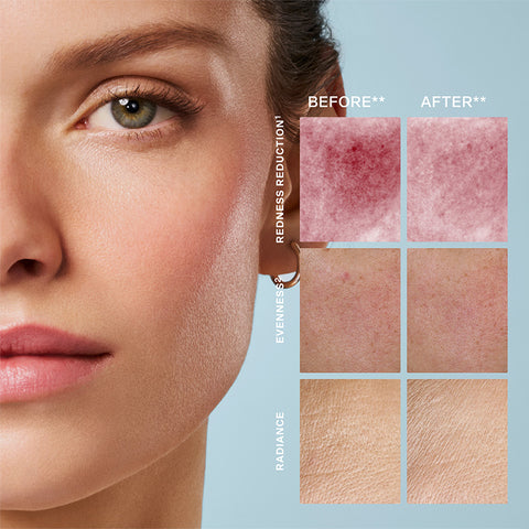 SERUM